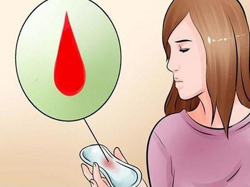 hỏi về chu kỳ kinh nguyệt để chẩn đoán bệnh phụ khoa