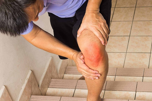viêm khớp dạng thấp là do phong hàn