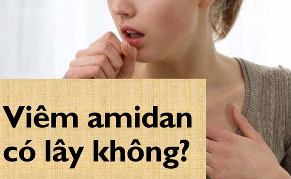 Bệnh nhân hỏi - Bác sĩ trả lời: Viêm amidan có lây không?
