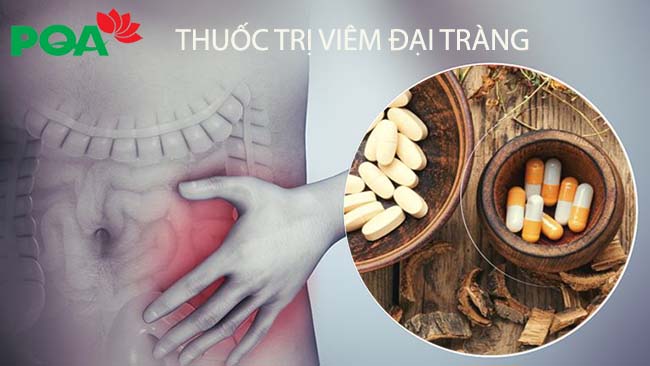 Bạn đã chọn cho mình loại thuốc trị viêm đại tràng tốt nhất?