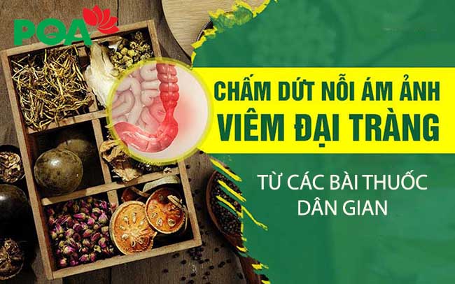 Chữa viêm đại tràng dứt điểm bằng kinh nghiệm dân gian