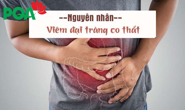 Để bác sĩ giải đáp cho bạn về bệnh viêm đại tràng co thắt