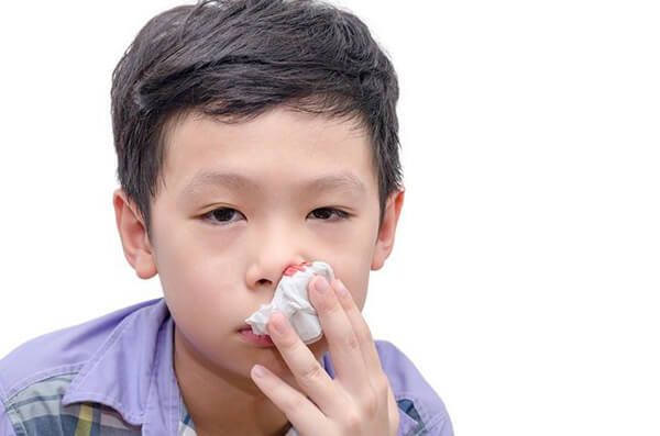 Chảy máu cam nhiều là dấu hiệu của bệnh gì? Nguy hiểm không? 