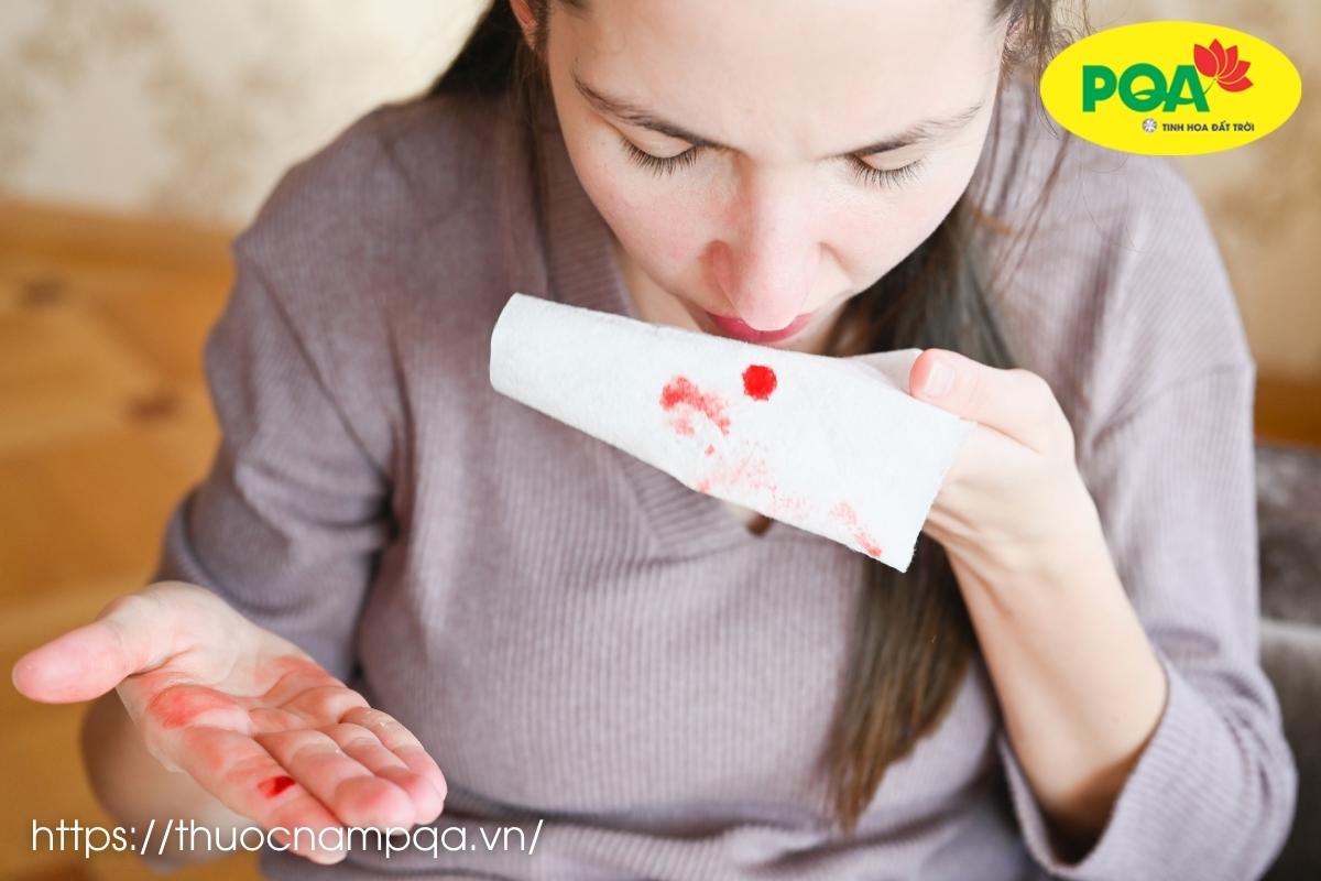 Bác sĩ chia sẻ phác đồ điều trị chảy máu cam