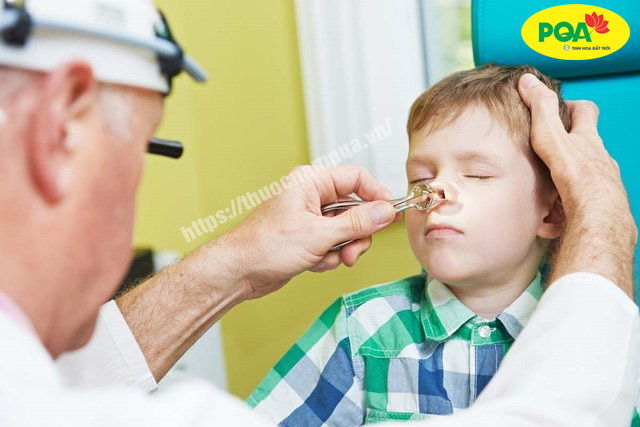 Bệnh viêm xoang ở trẻ em và cách chữa trị hiệu quả