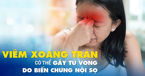 Viêm xoang trán: từ A - Z triệu chứng, nguyên nhân & cách điều trị