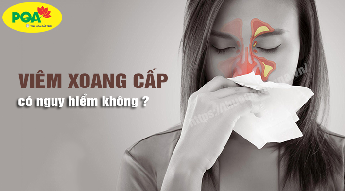 Viêm xoang cấp có nguy hiểm không? Nguyên nhân và cách chữa