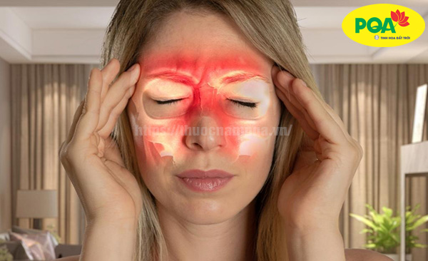 Viêm xoang nhức đầu nguyên nhân do đâu? Cách điều trị hiệu quả
