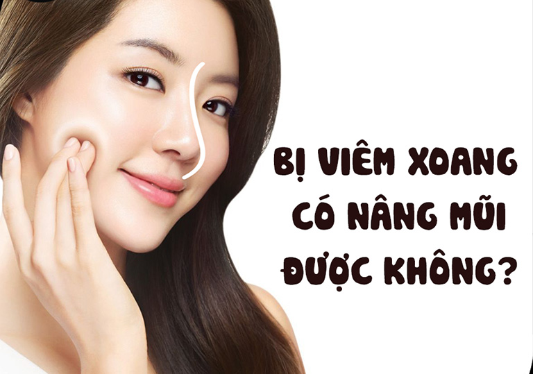 Tư vấn chuyên gia: bị viêm xoang có nâng mũi được không?