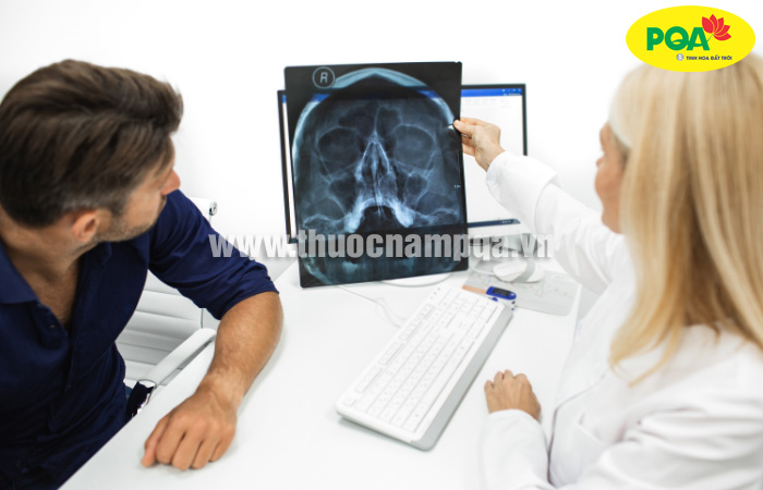 Tham khảo phác đồ điều trị viêm xoang của Bộ Y Tế chuẩn nhất 2023