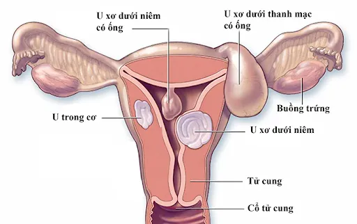 Tử cung là gì? Vai trò và những bệnh lý liên quan tới tử cung không thể bỏ qua