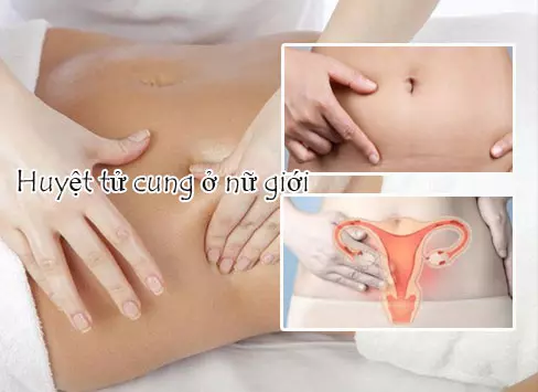 Hướng dẫn cách bấm huyệt hỗ trợ trị sa tử cung tại nhà