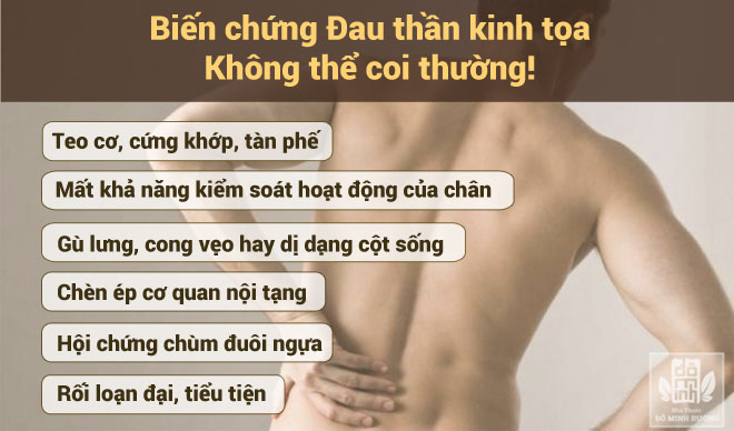 Đau thần kinh tọa là gì? Nguyên nhân, triệu chứng và cách chữa bệnh