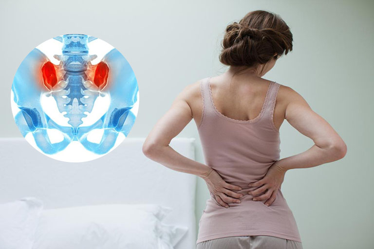 triệu chứng bệnh viêm khớp cùng chậu