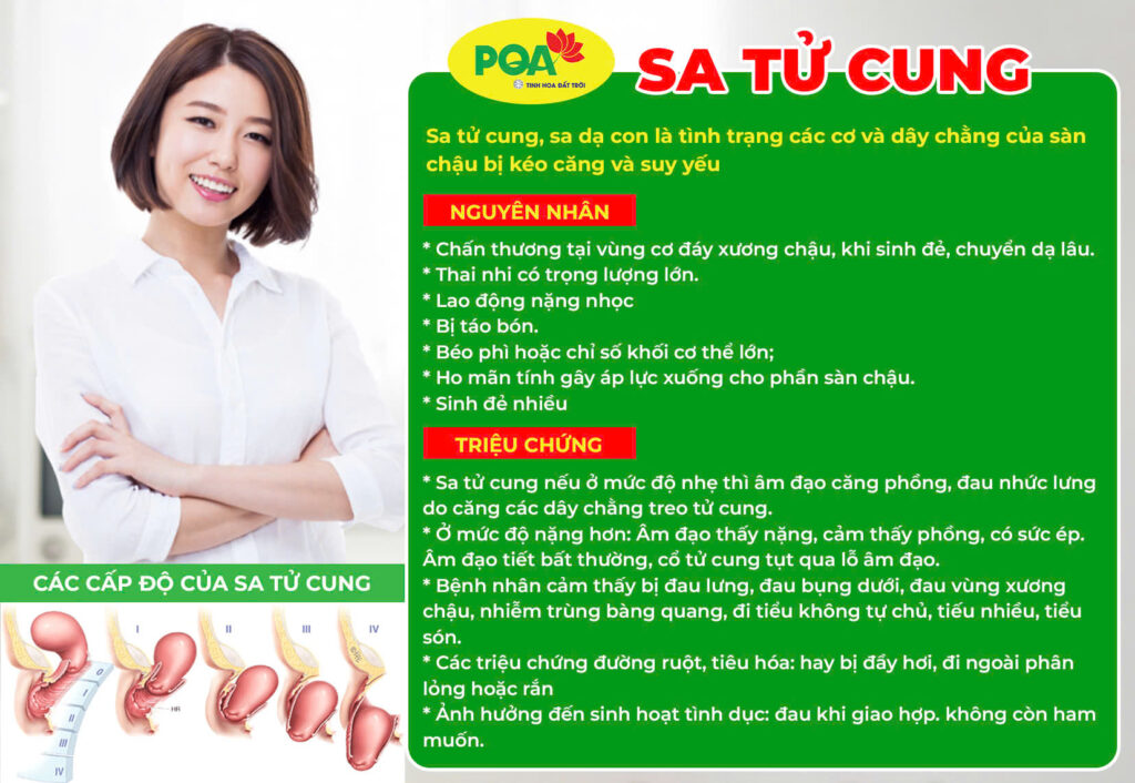 Nguyên nhân triệu chứng của sa tử cung