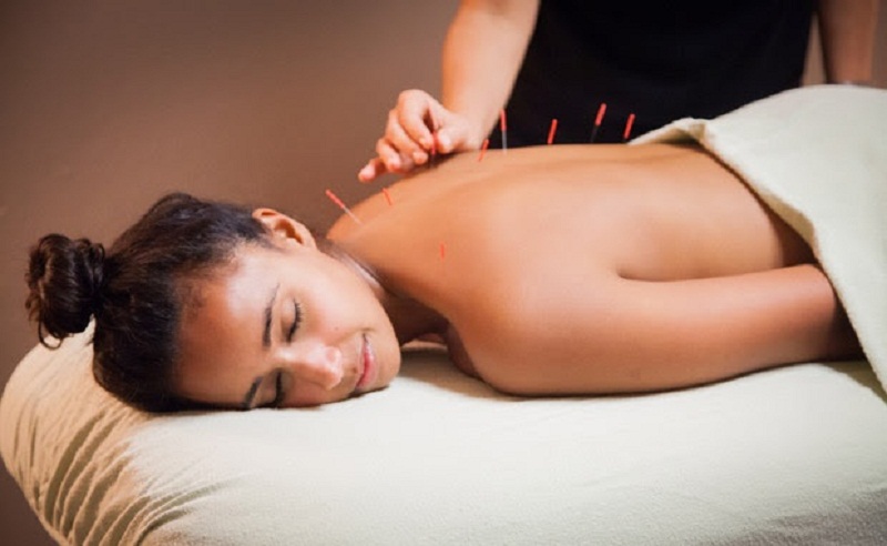 châm cứu giúp thư giãn xương