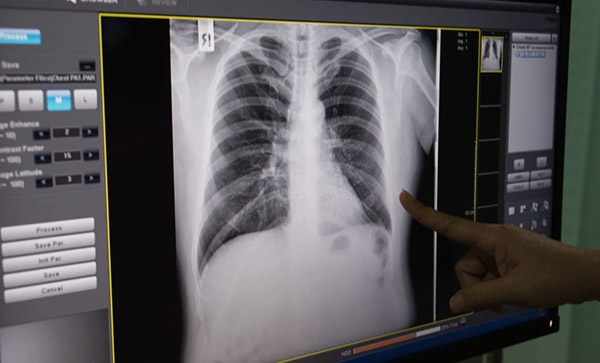 phân biệt hen phế quản và copd