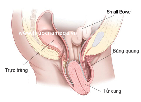 sa tử cung có nguy hiểm không