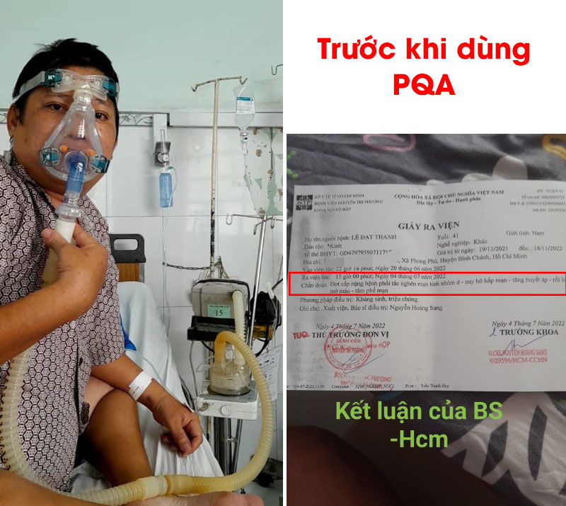 anh thanh trước khi dùng pqa
